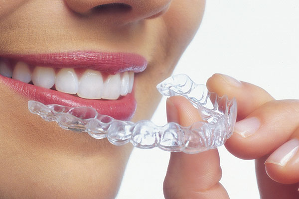 Invisalign clear aligner treatment at Elite Dental Touch by Dr. Maria Roman