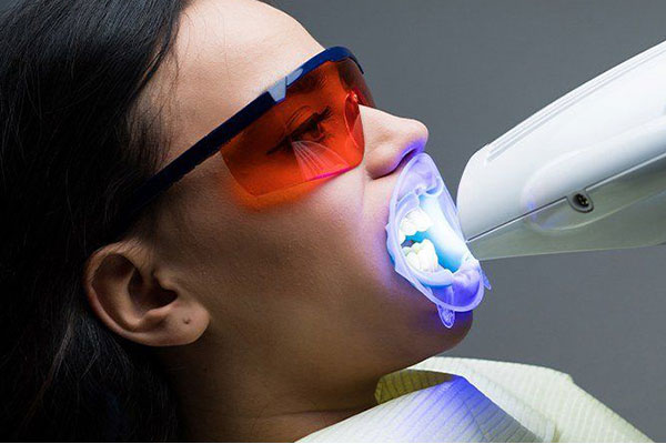 Grd.service Laser Teeth Whitening