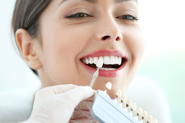 Dental veneers fitting at Elite Dental Touch for a beautiful smile