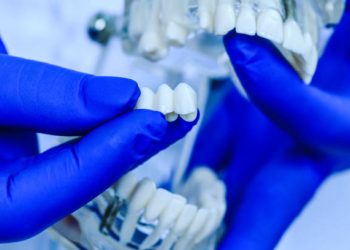 Dental Bridge 1 Doctor hands holding teeth model in dental clinic. Teeth model held by real dentist with blue gloves. Dentist showing a jaw model. Dentistry, dental care, healthy teeth, orthodontic and hygiene concept.