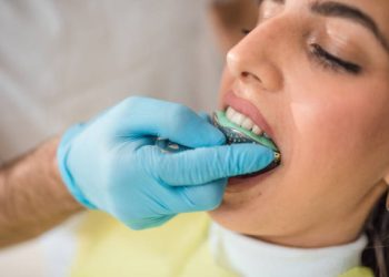 Dental Bridge 6 The dentist takes an impression of the patient's upper and lower jaw to make a prosthesis
