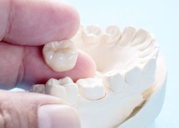 Dental Crown-Caps 5 Closeup / Prosthodontics or Prosthetic / Crown and bridge equipment and model express fix restoration.