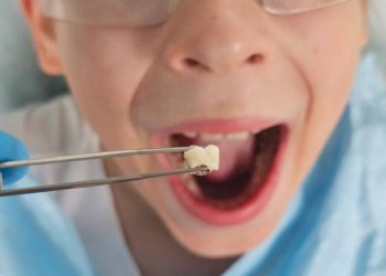 Tooth Extraction 1 A child holds a lost baby tooth with tweezers, grinning widely in a dental clinic