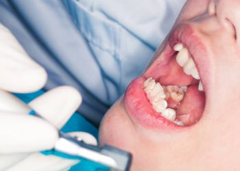 Tooth Extraction 4 Dentist examining patient