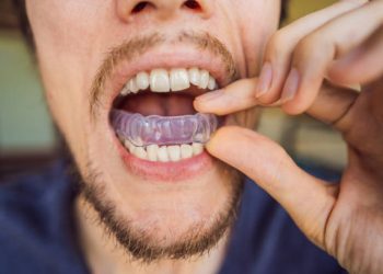 Nightguards / Mouthguards 1 Man placing a bite plate in his mouth to protect his teeth at night from grinding caused by bruxism, close up view of his hand and the appliance.