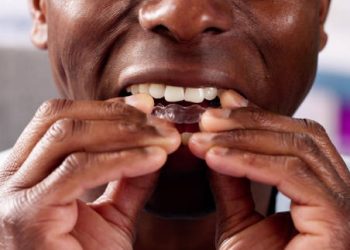 Nightguards / Mouthguards 3 Clear Aligner Dental Night Guard For Teeth
