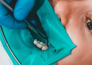 Root Canal 2 treatment of a chewing tooth, the dentist put a rubber dam, uses sterile tools, uses modern technology.2020