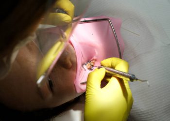 Root Canal 7 Close-up shot of attentive doctors performing surgical operation installing dental implants into patient's mouth in modern dental clinic. Dental instruments. Stomatology clinic.