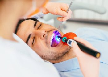 Tooth Bonding 8 Female dentist using a dental curing light.