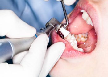 Teeth Cleaning 7 Dentist examining patient