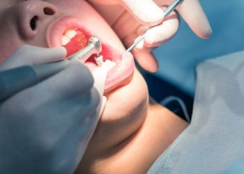 Teeth Cleaning 8 Dentist examining patient