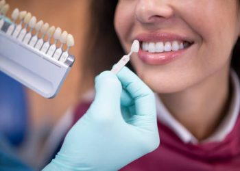 Dentist uses a palette tooth color sample to determine shade of patient's teeth.