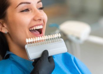 A beautiful young patient uses a dental tooth shade guide for whitening teeth service to ensure a perfect choice of color. Bleaching, prosthetics, orthopedic dentistry concept.