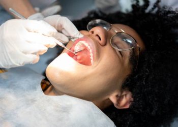 Wisdom Teeth Removal 3 Close-up on a patient at the dentist getting his teeth examined - healthcare and medicine concepts