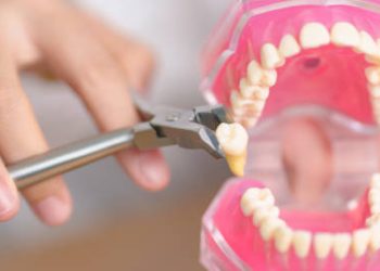 Wisdom Teeth Removal 4 Dentist with tooth Anatomy model. Oral Teeth and disease, Scrape off tartar. March Oral health, Dentist Day, False Teeth. Toothache and Children Dental Health Month and Orthodontic Health Day