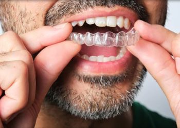 Invisalign 3 Edt Service Invisalign 15