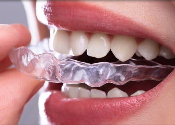 Invisalign 6 Edt Service Invisalign 23