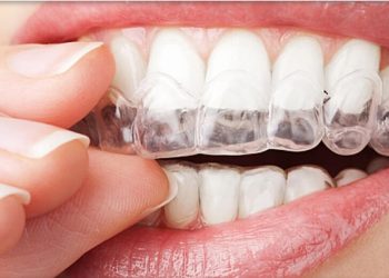 Invisalign 7 Edt Service Invisalign 25
