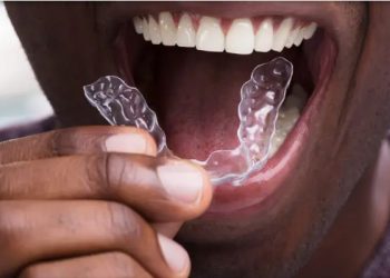 Invisalign 8 Edt Service Invisalign 27