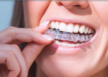 Invisalign 9 Edt Service Invisalign 31