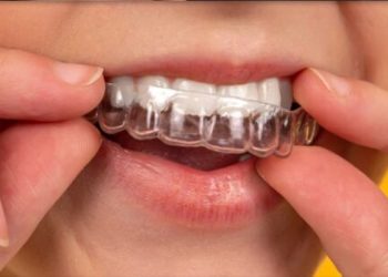 Invisalign 10 Edt Service Invisalign 33