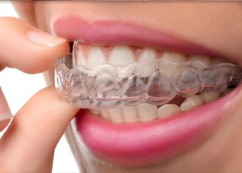 Invisalign 11 Edt Service Invisalign 35