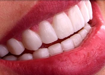 Smile Design 4 Edt Service Smile 11