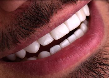 Smile Design 3 Edt Service Smile 13