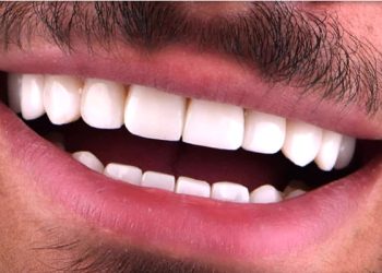 Smile Design 9 Edt Service Smile 27