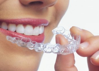 Why Choose Us 9 Invisalign clear aligner treatment at Elite Dental Touch by Dr. Maria Roman