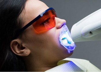 Why Choose Us 8 Grd.service Laser Teeth Whitening